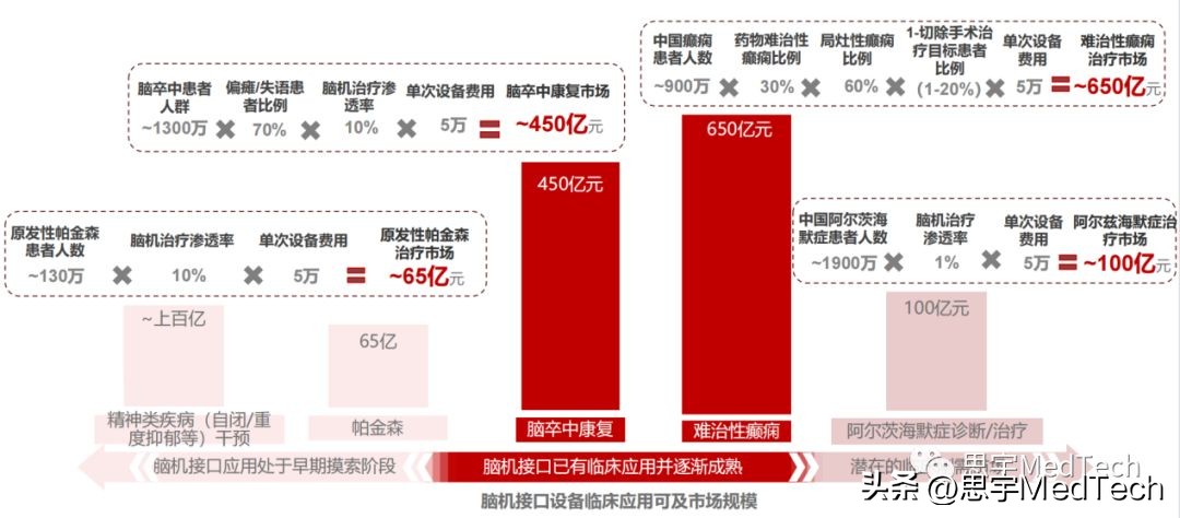 一文读懂马斯克展示脑机接口,一文读懂脑机接口