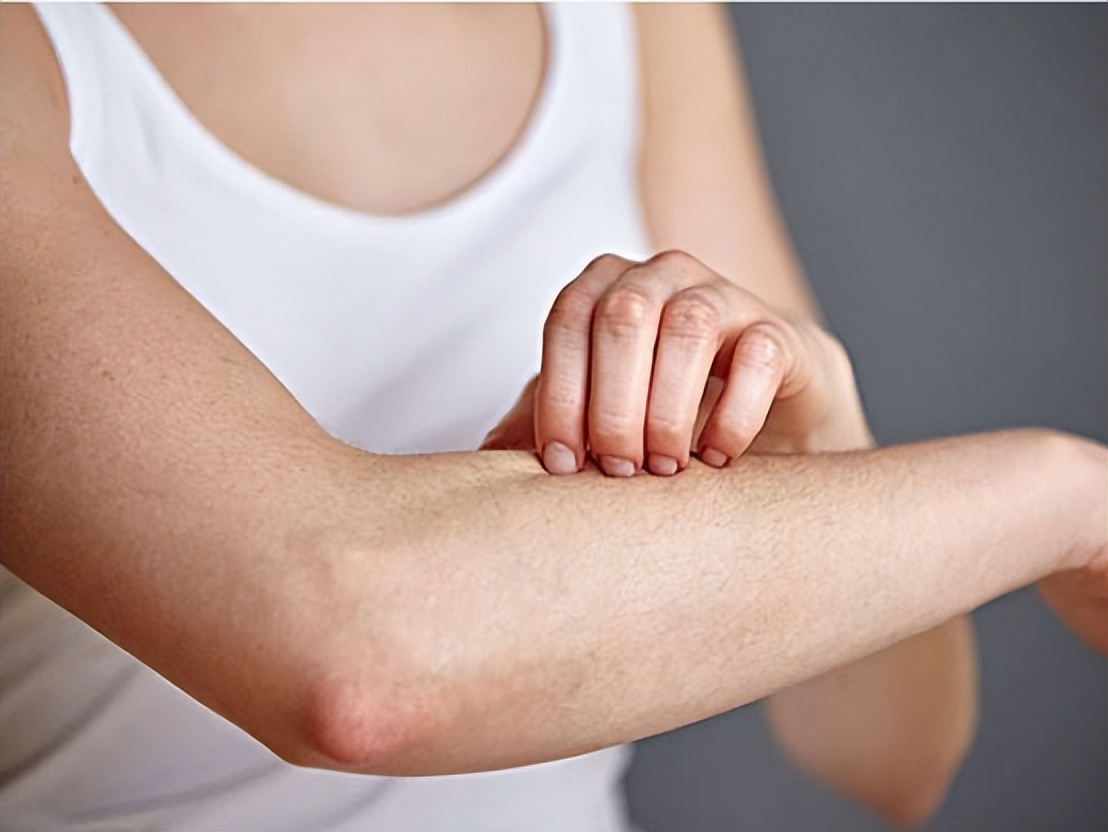 神经性皮炎喝过中药后为啥更痒,手越抓越痒是皮炎还是真菌感染