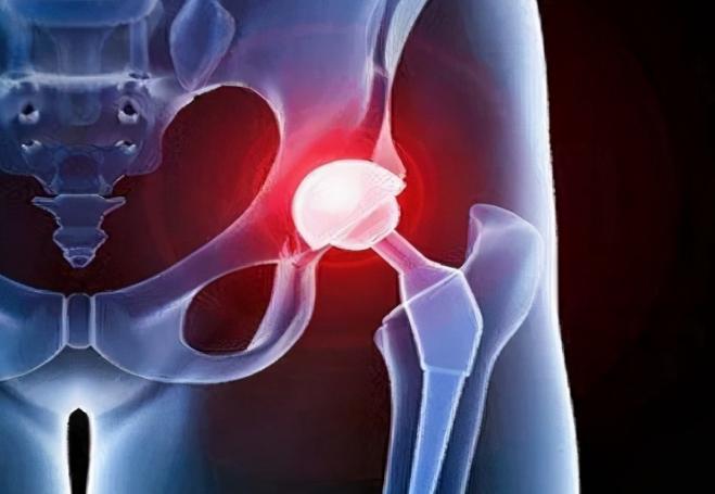 胯骨疼是什么原因造成的,胯骨疼是什么原因引起来的