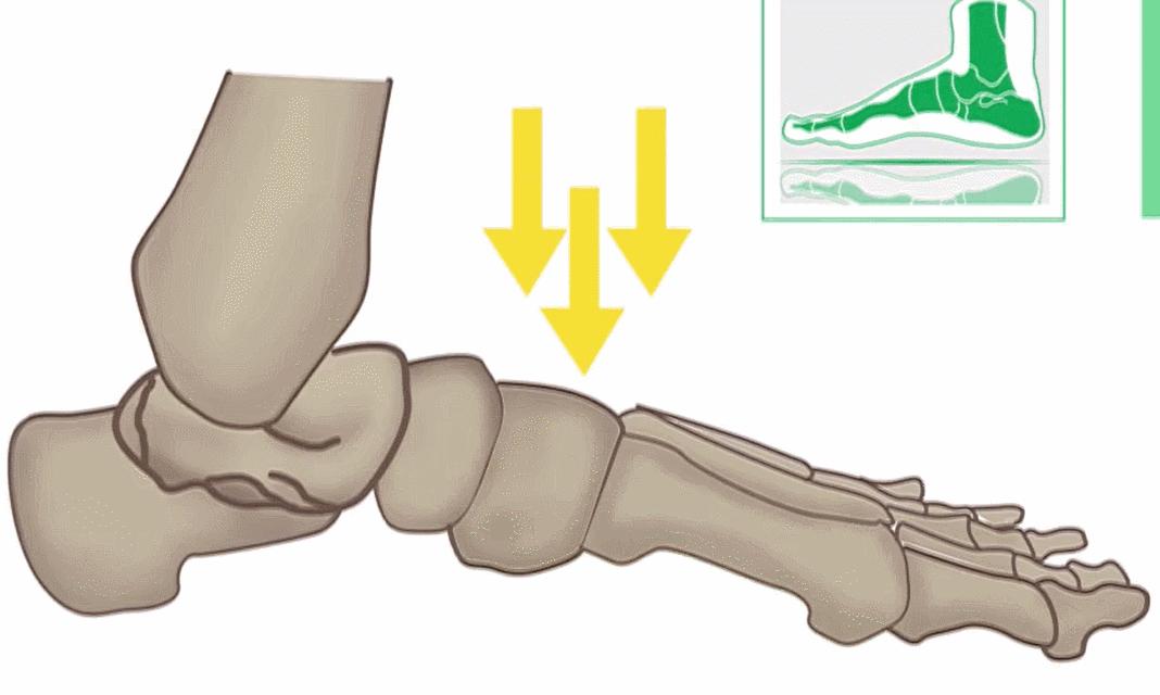 鞋子太紧穿不舒服怎么办,鞋子太松不跟脚