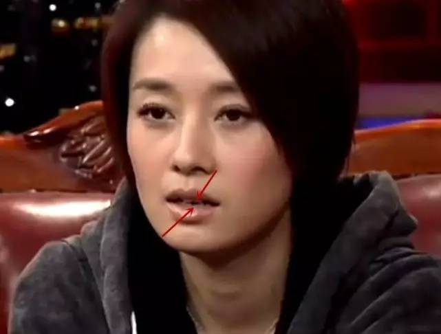 烤瓷牙的明星,烤瓷牙的明星都有谁