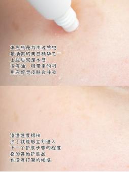 大牌抗老美白精华,大牌美白淡斑精华排行榜10强