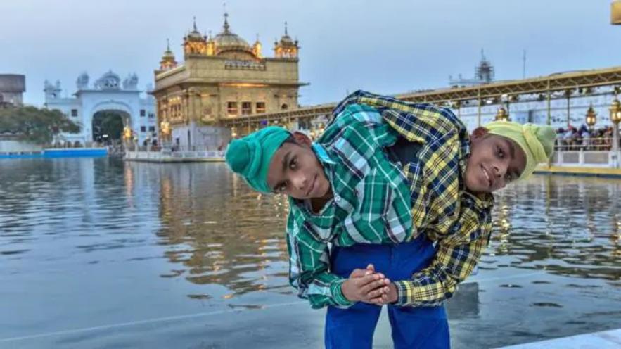 邦克兄弟连体人,连体人怎么进行生育