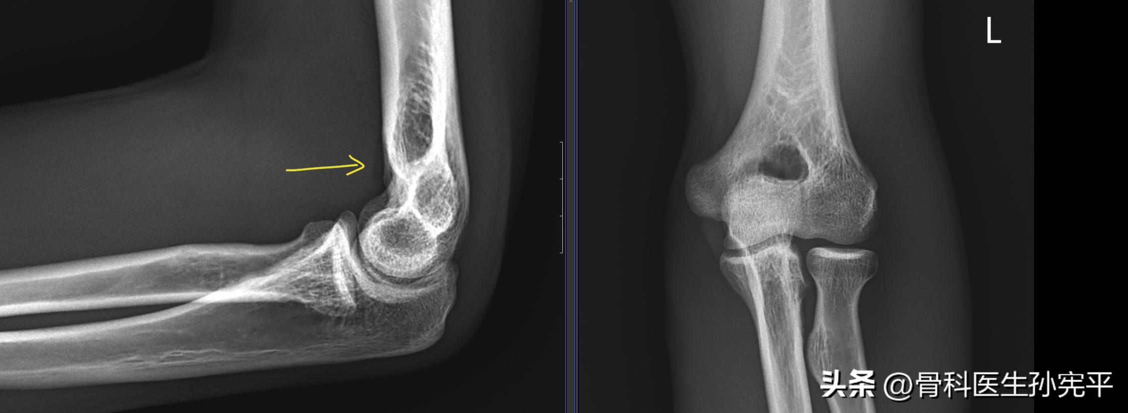 医学影像趣图,震撼的医学影像