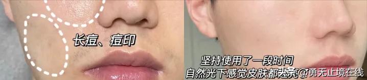 热门水乳真实测评｜避免智商税高性价比保湿美白修复水乳套装推荐