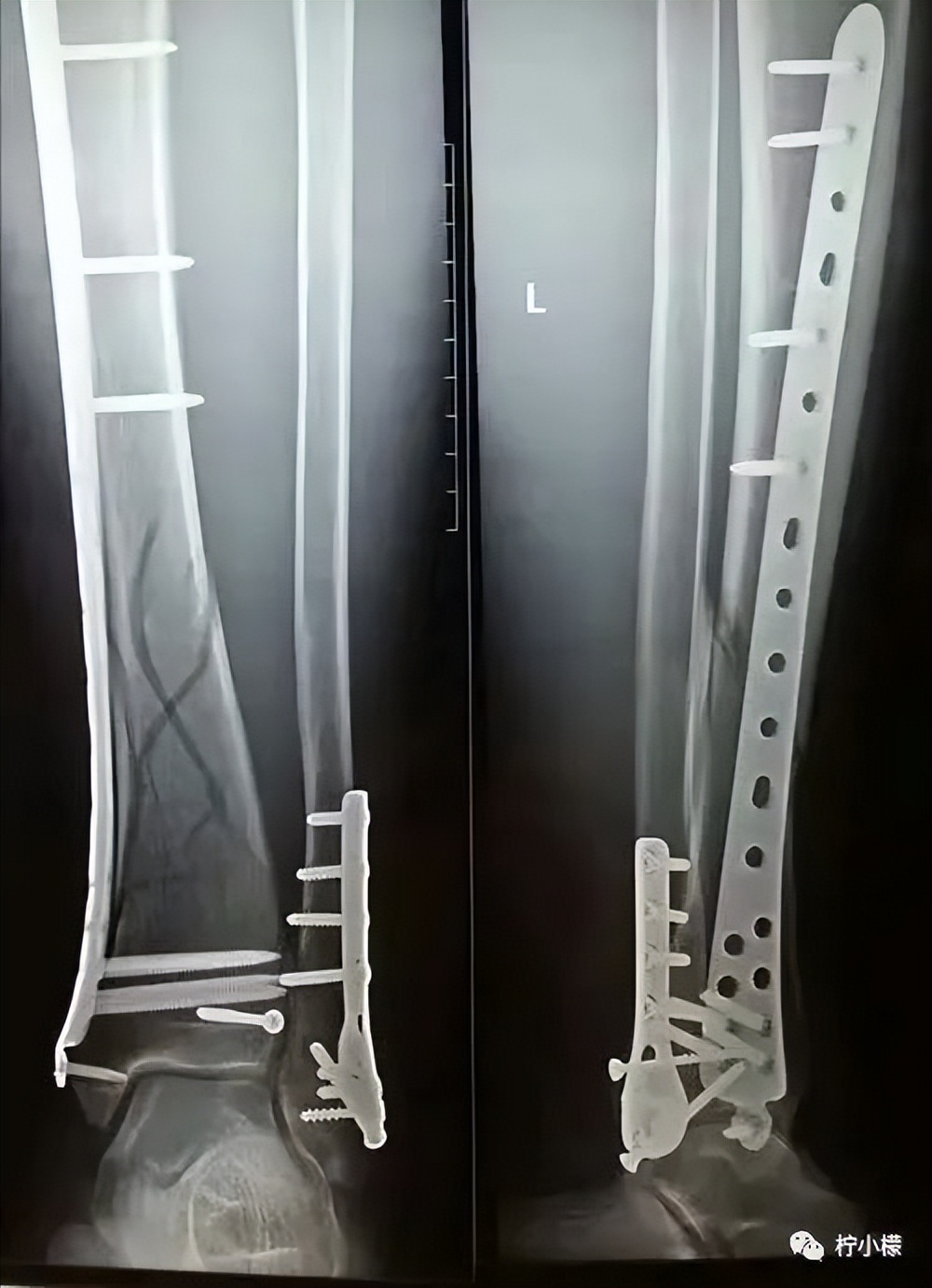 向女神表白最尴尬的事 (发消息向女神表白很久才回复)