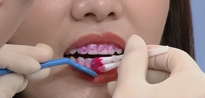 什么品牌的电动牙刷好测评,如何选择电动牙刷型号及价格