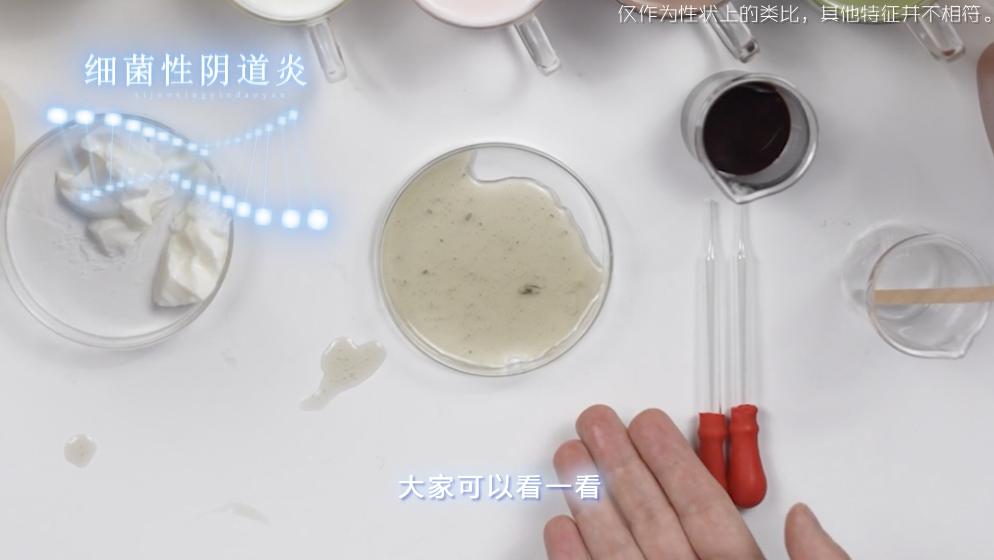 健康白带的形态,健康的白带是什么颜色的