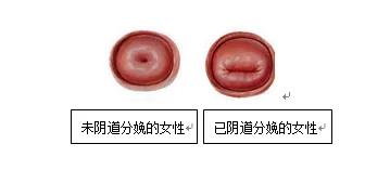 子宫大小与妊娠周数相符,妊娠子宫体积