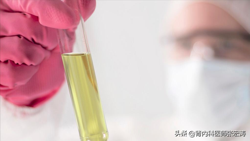 如何解读医学检验单之尿常规,尿常规检验报告单解读