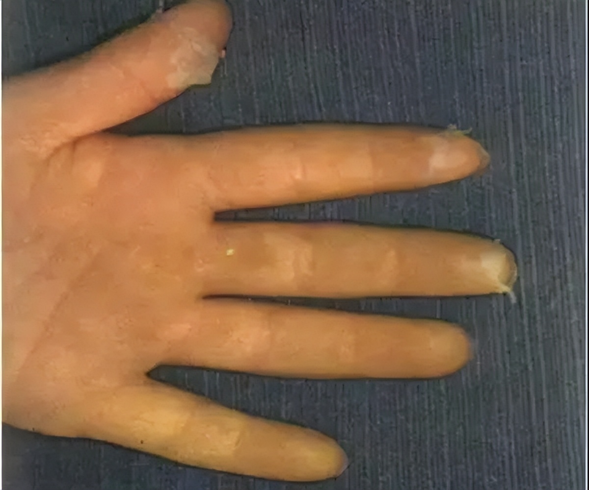 小儿舌头的各种症状如何解决,儿童舌头红色颗粒状怎么治疗