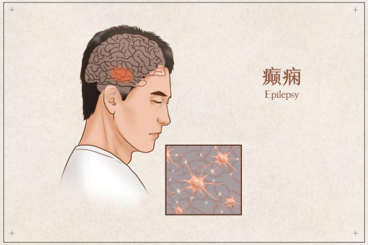 一切气病，先开四关，首尾呼应，阴阳相配，疏通气血