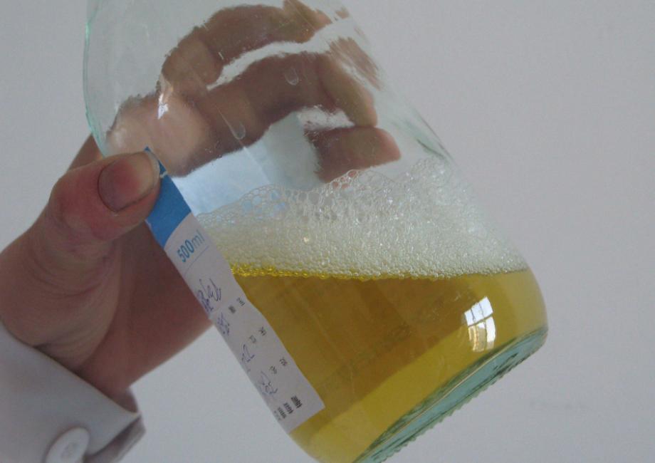 尿蛋白偏低如何治疗,肾炎尿蛋白降不下怎么办