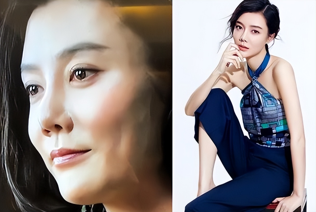 颧骨高的女人为什么瘦下来显老,颧骨高苹果肌凹陷的女人