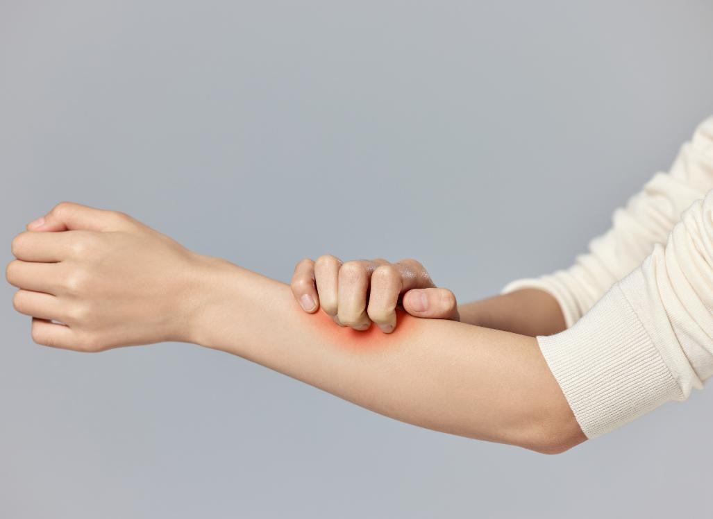 敷中药过敏如何快速消除过敏瘙痒,过敏皮肤瘙痒怎么快速缓解