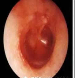 爱耳小知识,爱耳日科普