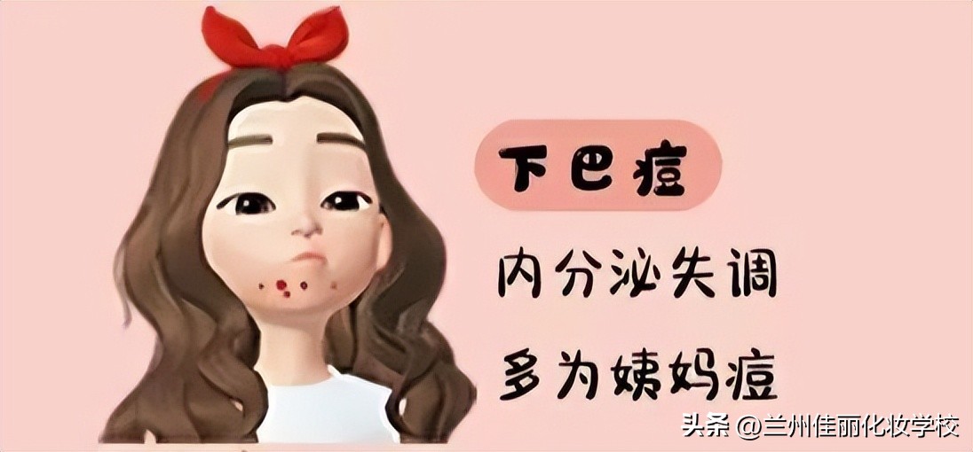 脸上的痘坑痘印毛孔粗大,毛孔粗大缺水还有痘印和螨虫痘