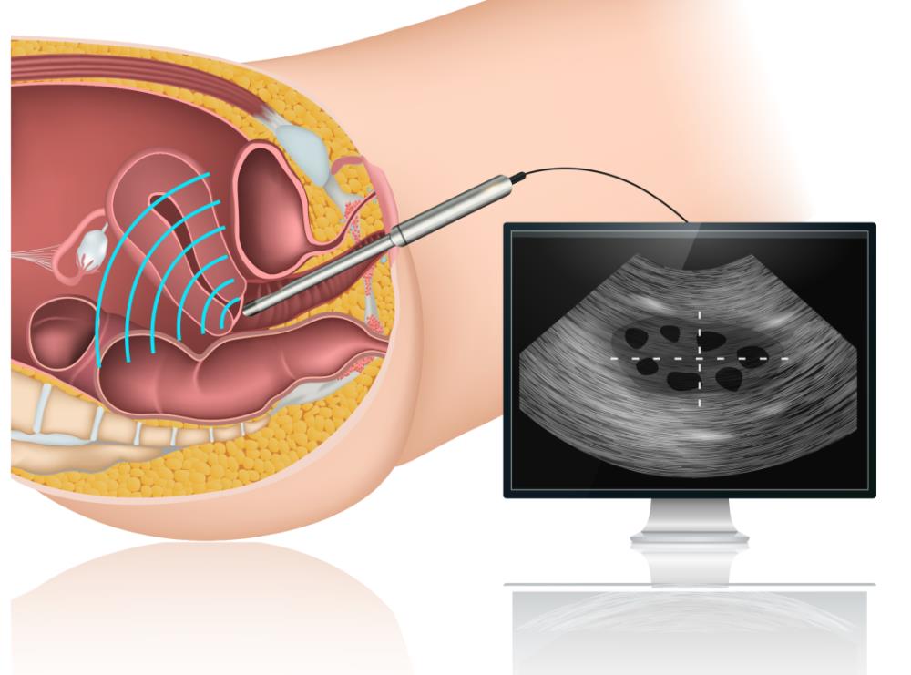 20岁女大学生“捐卵”差点死了，但很多人从中赚钱。