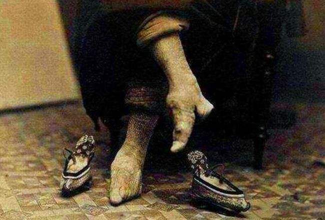 女人小脚为啥叫三寸金莲,古代女人是三寸金莲脚吗