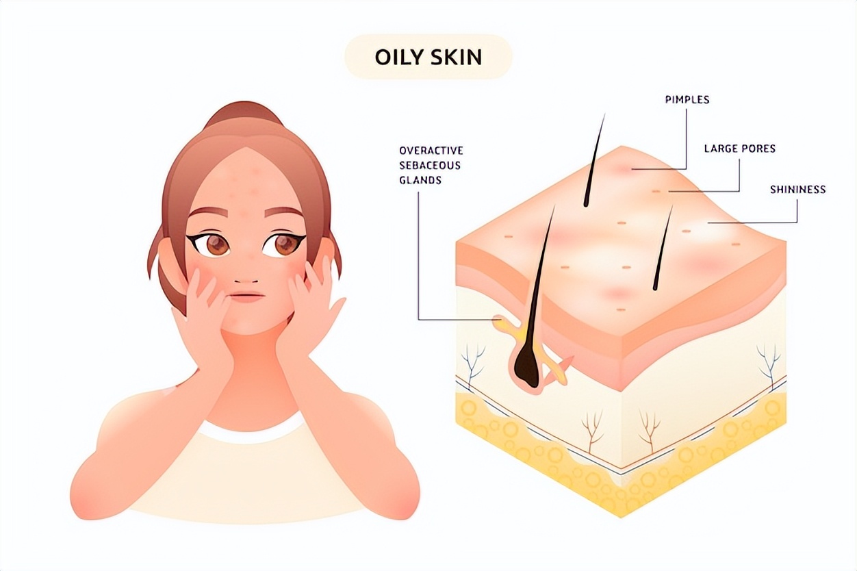 脸上冒痘头皮长痘怎么回事,头皮反反复复长痘是什么原因