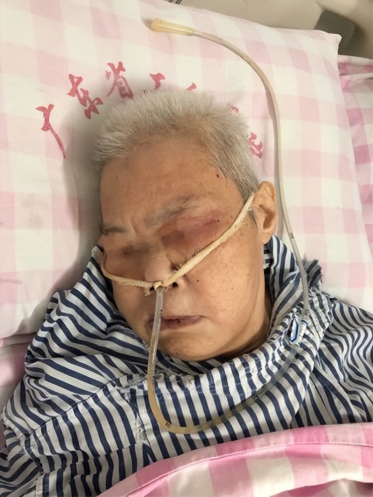 老年人结直肠癌患者危险因素及应用加速康复外科的临床治疗如何？