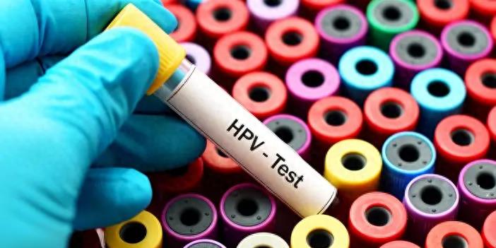 世界十大最美已去世的女人,世界上最漂亮的女孩去世