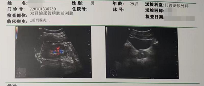 慢性前列腺炎长期不治的后果,前列腺炎拖延不治有什么影响