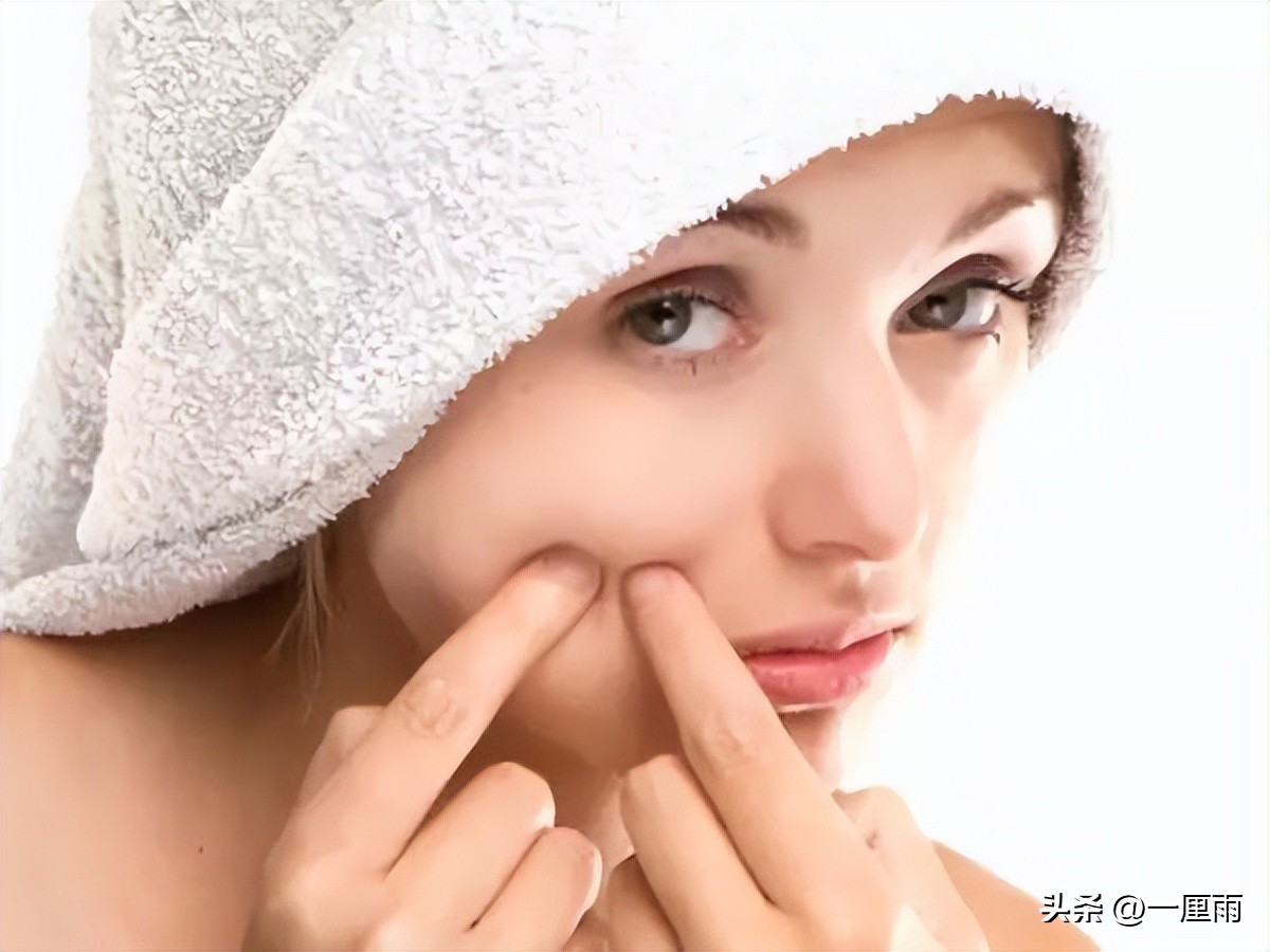 脸上起痘祛痘印的最佳方法,脸上痘痘痘印很严重如何快速祛痘