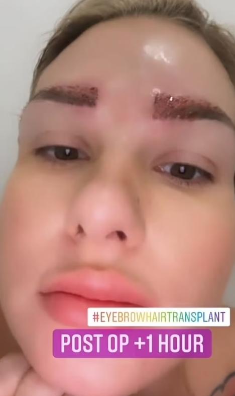 植眉后眉毛要一直修剪,细眉变浓眉最好的方法