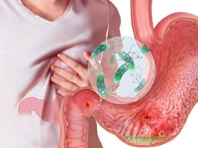 一瓶甲硝唑片多少钱,甲硝唑几块和几十块的有区别吗