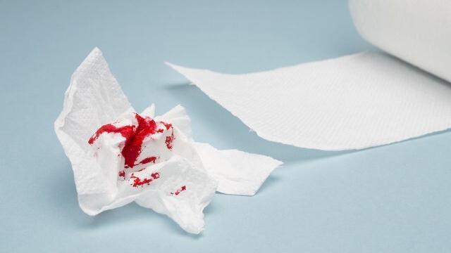 肛裂痔疮引起的便血什么样,痔疮便血跟肛裂便血的区别