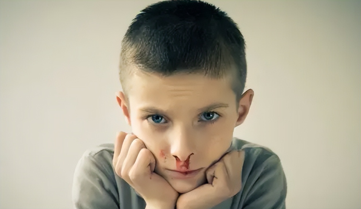 流鼻血花费一千多,治疗流鼻血喝中药可以改善么