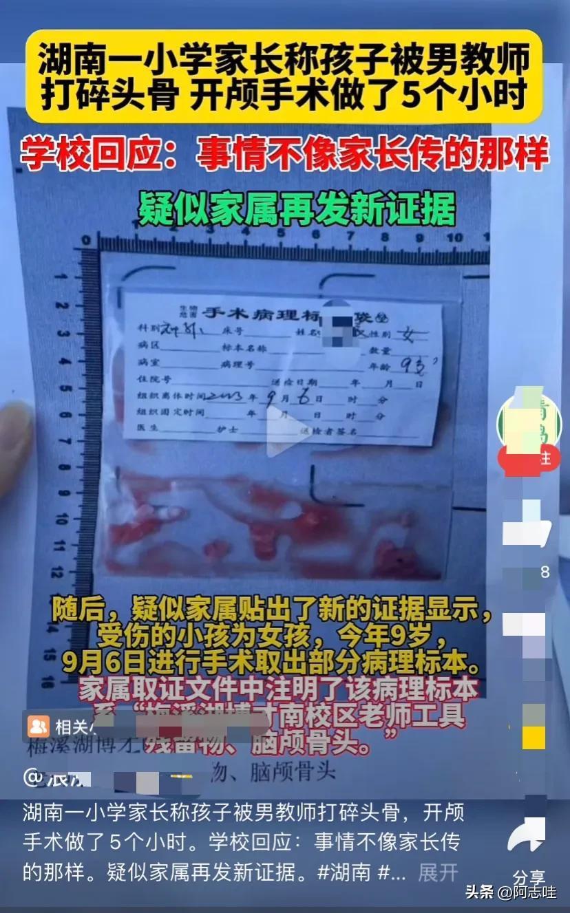 体罚打手心打到哭视频太惨了！长沙9岁女孩被男老师打得脑浆炸