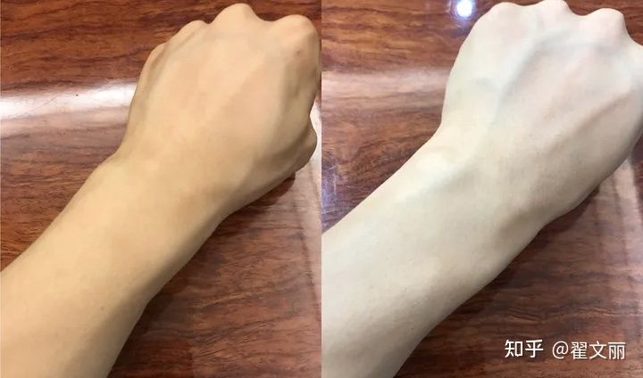 中药祛斑美白养颜精华套装第3代,美白淡斑祛斑精华真实测评