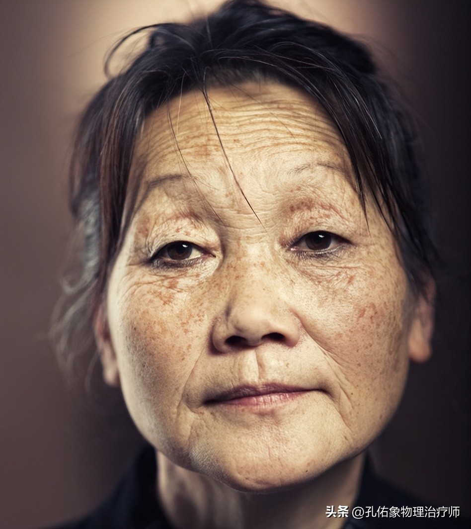 为什么人老会有老年斑怎么消除,为什么会有老年斑怎么去掉