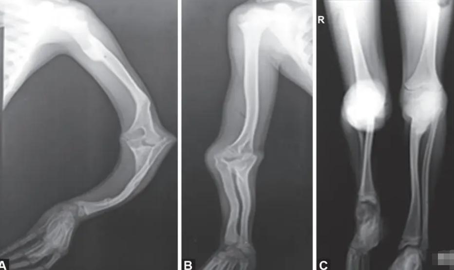 轮椅上的总裁身价3亿娶漂亮老婆,身价过亿总裁坐轮椅