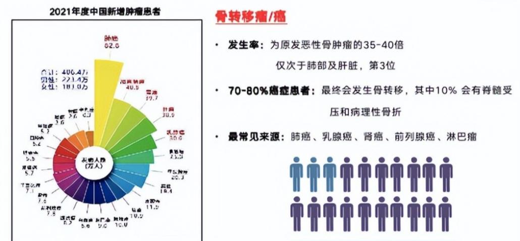 80%的肿瘤患者死于复发转移,74岁癌症晚期转移还能活多久