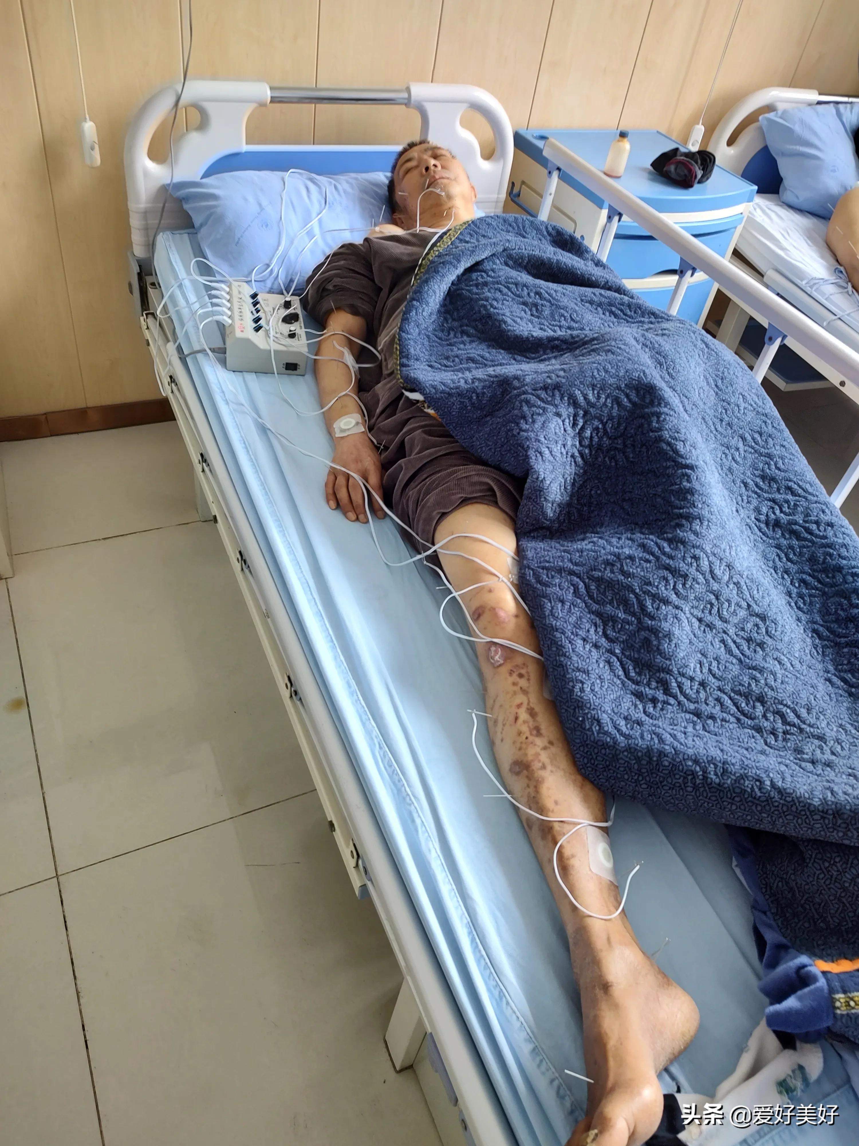 关于脑出血术后康复治疗那些事儿