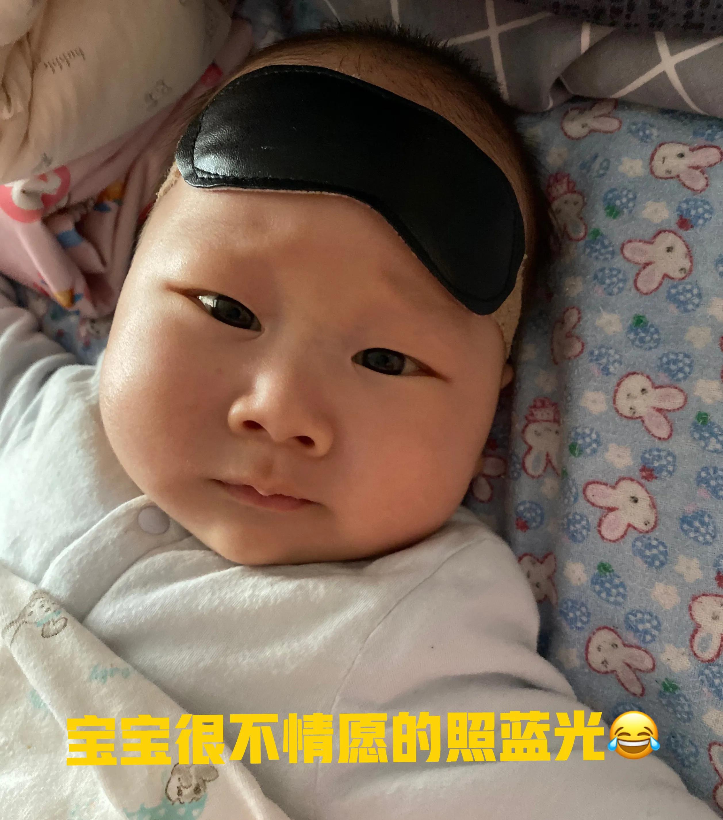 黄疸两个月还没退下去怎么办,母乳性黄疸两个月还没退