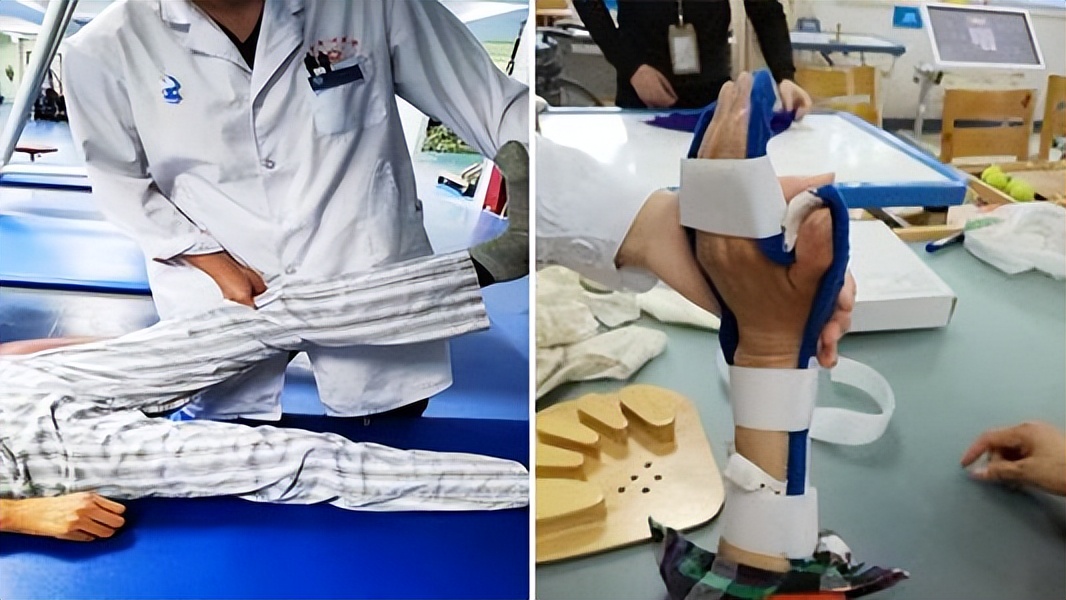 Machado-Joseph病是常染色体显性遗传病，目前没有特定的治疗方法