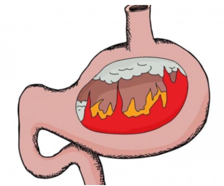 口苦是肝热还是肝寒,口苦是肝的问题还是胆的问题