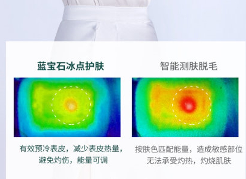 ulike脱毛能永久脱毛吗,ulike脱毛前可以用脱毛膏脱毛吗