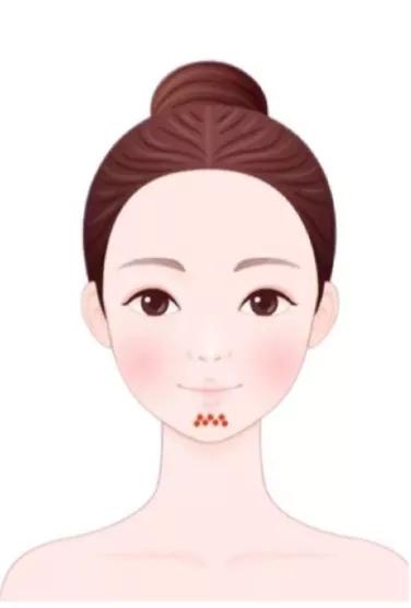 治疗痘痘和痘印最有效的产品内调,腮边反复长大硬包痘痘怎么内调