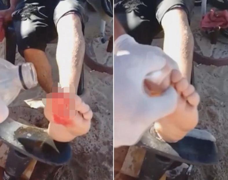 巴西一球员遭食人鱼啃食,巴西球员被食人鱼吃剩骨架