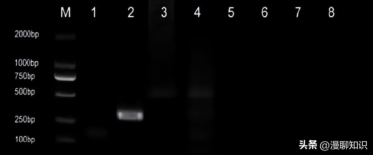 猫会感染人的疾病的图片,猫病毒检测cpr可以测出什么病毒