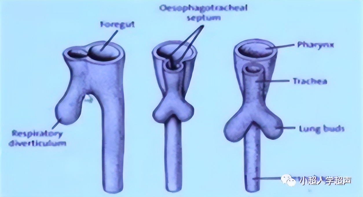食道闭锁超声表现,食管闭锁一型手术过程