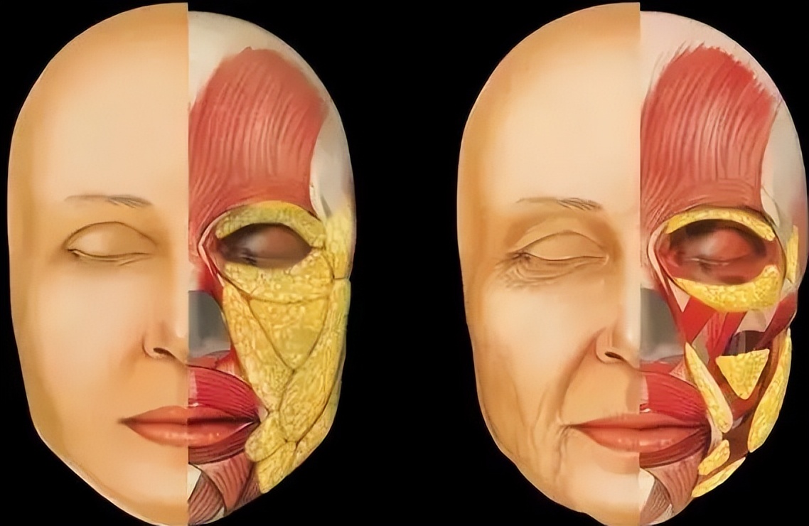 苹果肌塌陷不饱满怎么办,苹果肌干瘪怎么办