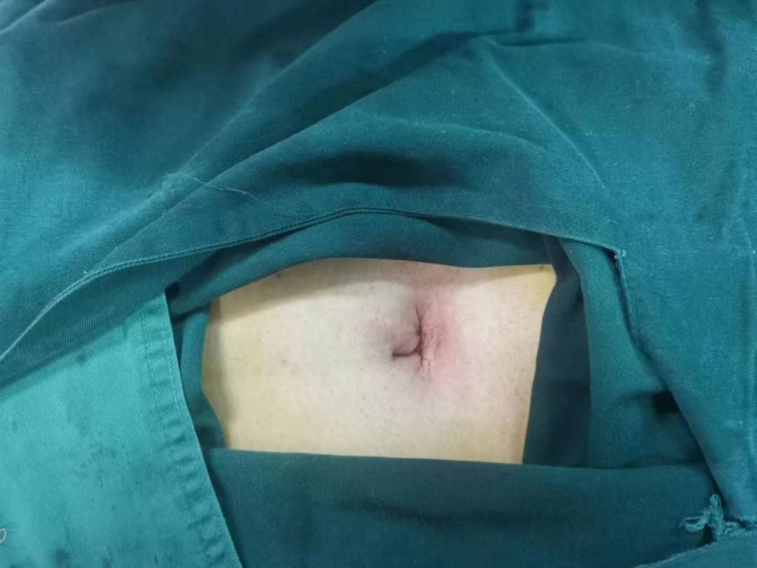 得了子宫腺肌症必须切除子宫吗,子宫腺肌症严重了只能切除子宫吗