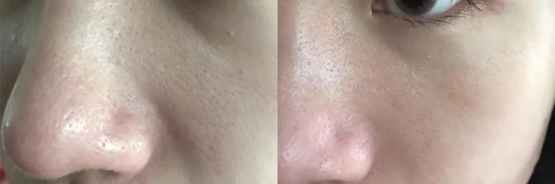 vidivici蚕丝美白保湿洗面奶,vidivici洗面奶和香奈儿洗面奶