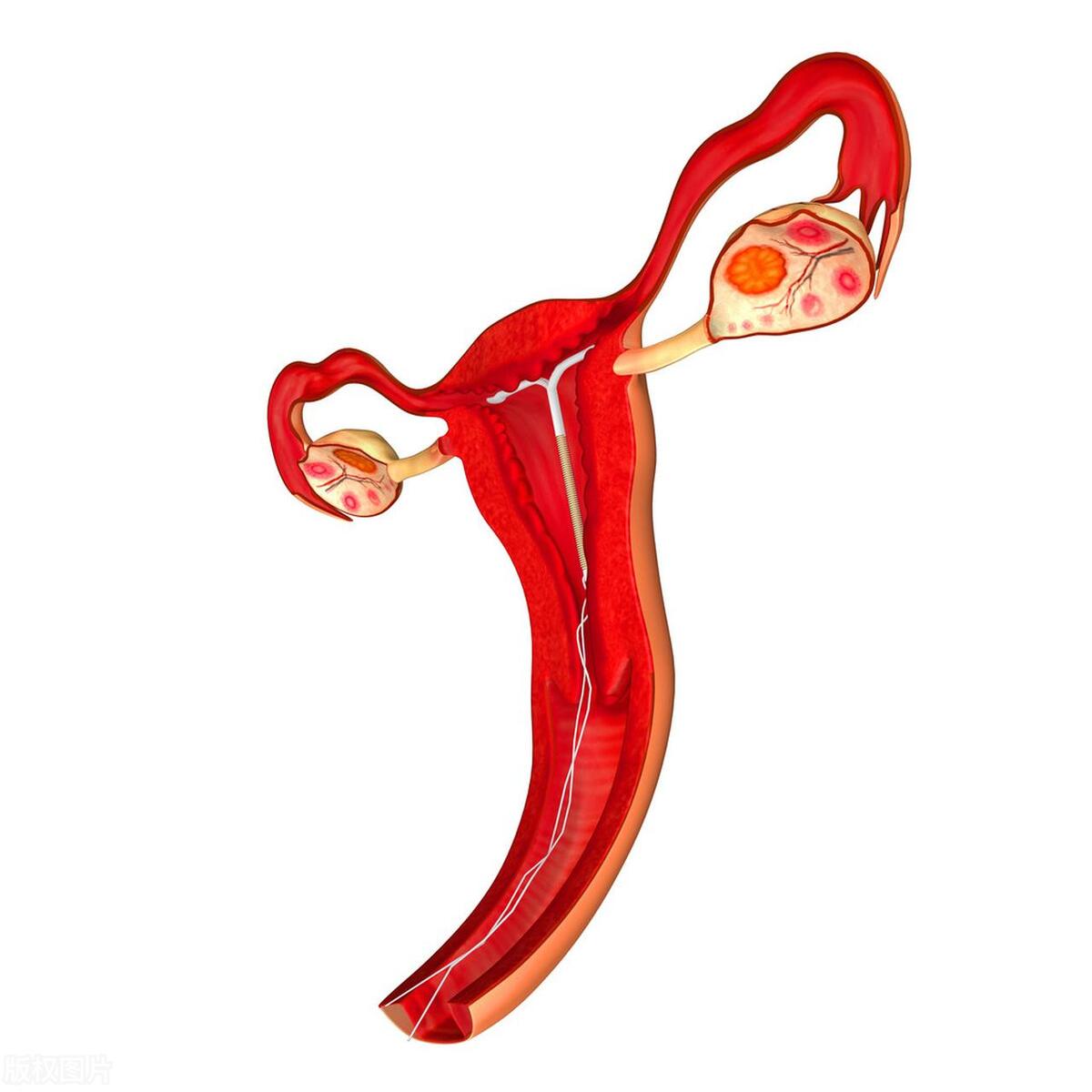 女人上环什么时期是最好的,女性上环的种类和形状